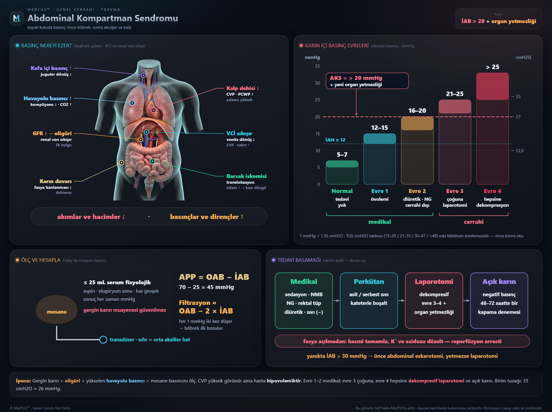 Abdominal kompartman sendromu — İAB evreleri, fizyopatoloji, dekompresyon