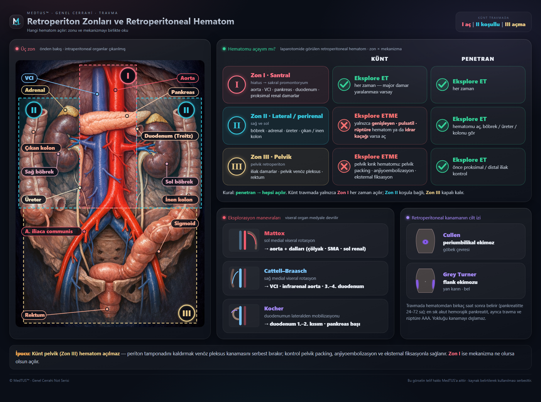 Retroperiton ve pelvis travması — Hematom zonları, pelvis kırığı, üretra, böbrek