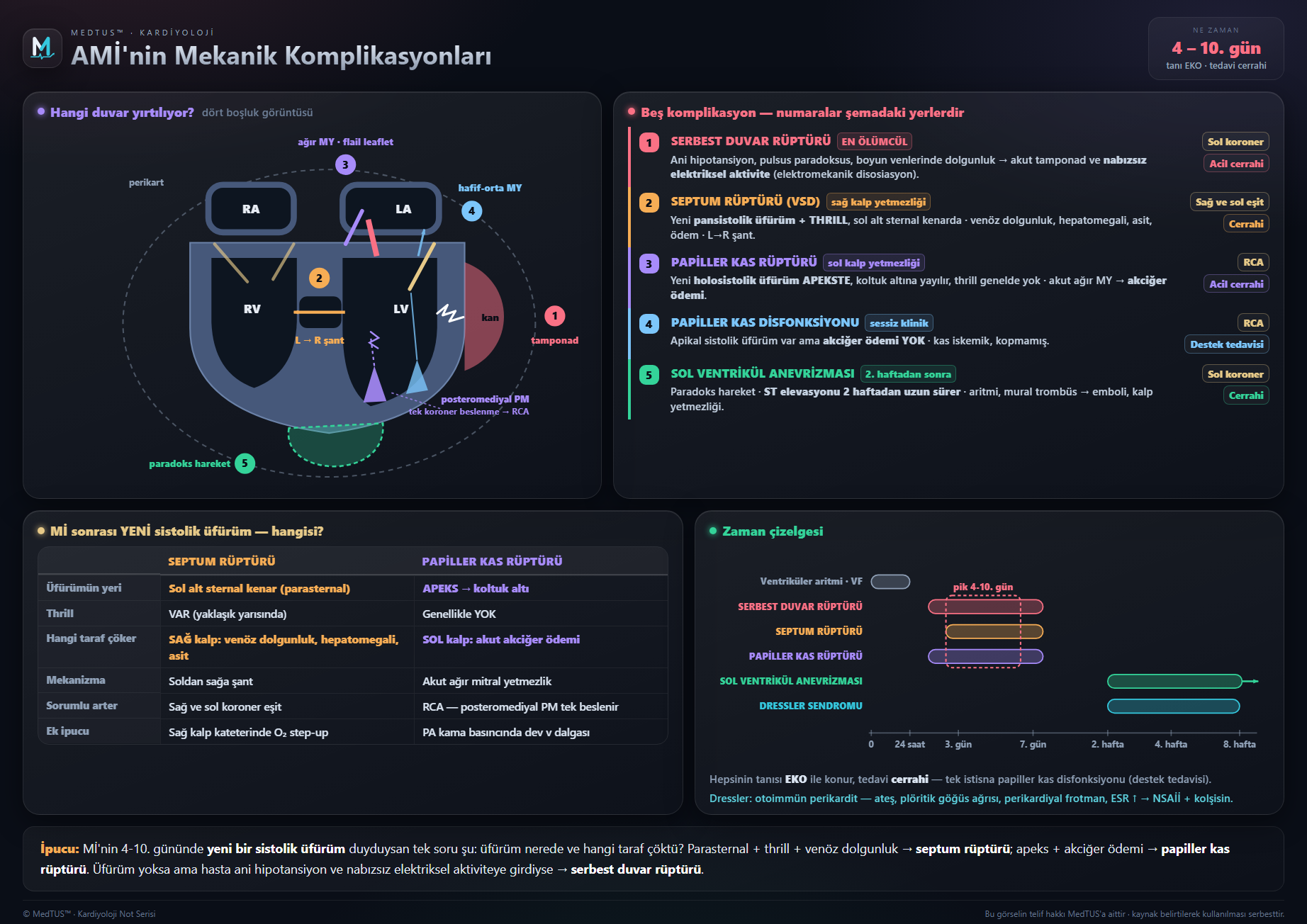MI komplikasyonları — Mekanik, aritmik, sağ ventrikül MI, Dressler
